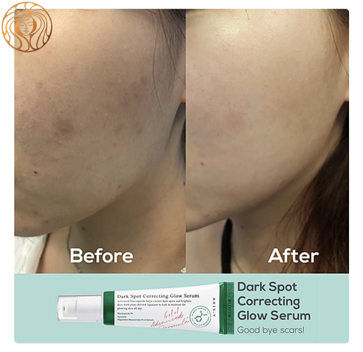سرم ضد لک اکسیس وای مدل Dark Spot حجم 50 میلی لیتر